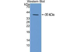 Western blot analysis of the recombinant protein. (PKC gamma anticorps  (AA 351-614))
