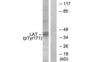 Western blot analysis of extracts from Jurkat cells treated with UV 15', using LAT (Phospho-Tyr171) Antibody. (LAT anticorps  (pTyr200))