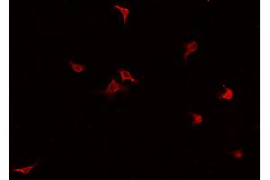 ABIN6269219 staining HUVEC cells by IF/ICC. (Cadherin 5 anticorps  (C-Term))