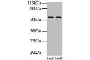 Western blot All lanes: IMPDH2 antibody at 2 μg/mL Lane 1: EC109 whole cell lysate Lane 2: 293T whole cell lysate Secondary Goat polyclonal to rabbit IgG at 1/15000 dilution Predicted band size: 56 kDa Observed band size: 56 kDa (IMPDH2 anticorps  (AA 5-514))