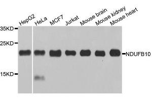 Western blot analysis of extracts of various cell lines, using NDUFB10 antibody. (NDUFB10 anticorps  (AA 1-172))