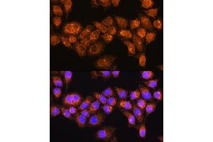 Immunofluorescence analysis of HeLa cells using R Rabbit pAb (ABIN7269787) at dilution of 1:100. (RABL3 anticorps  (AA 1-236))