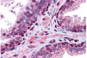 Human Prostate: Formalin-Fixed, Paraffin-Embedded (FFPE) (GID8/C20orf11 anticorps  (C-Term))