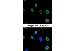 ICC/IF Image Immunofluorescence analysis of paraformaldehyde-fixed HeLa, using TAP , antibody at 1:200 dilution.