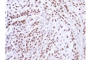 IHC-P Image Immunohistochemical analysis of paraffin-embedded A549 xenograft , using ZNF346, antibody at 1:100 dilution. (ZNF346 anticorps)