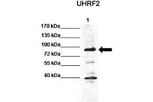 WB Suggested Anti-Uhrf2 Antibody  Positive Control: Lane 1: 60ug HCT116 lysate  Primary Antibody Dilution :  1:1000 Secondary Antibody : Anti rabbit-HRP  Secondry Antibody Dilution :  1:5,000 Submitted by: Chinweike Ukomadu, Brigham and Women's Hospital, Boston (UHRF2 anticorps  (N-Term))