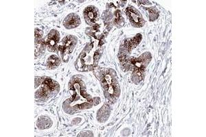 Immunohistochemical staining of human breast with KIAA1586 polyclonal antibody  shows strong cytoplasmic positivity in glandular cells at 1:50-1:200 dilution. (KIAA1586 anticorps)