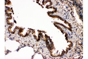 IHC(P): Rat Lung Tissue (MAP2K7 anticorps  (N-Term))