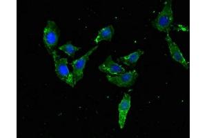 anti-Transcription Factor EB (TFEB) (AA 1-476) antibody