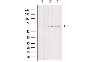 Western blot analysis of extracts from various samples, using SLC9A9 Antibody. (SLC9A9 anticorps  (Internal Region))