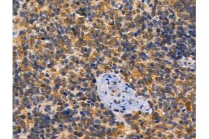 ABIN6257673 and ABIN6274842 at 1/100 staining Mouse spleen tissue by IHC-P.