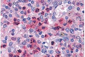 Human Neutrophils: Formalin-Fixed, Paraffin-Embedded (FFPE)