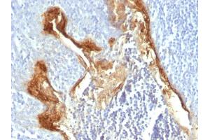 Formalin-fixed, paraffin-embedded human Tonsil stained with Involucrin Monoclonal Antibody (IVRN/827) (Involucrin anticorps)