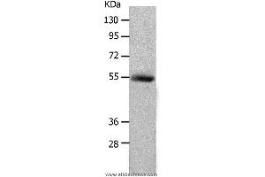 Western blot analysis of Human colon cancer tissue, using MMP17 Polyclonal Antibody at dilution of 1:550