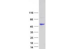 Validation with Western Blot