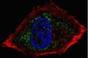 Fluorescent confocal image of HepG2 cells stained with NeuroD1 antibody.