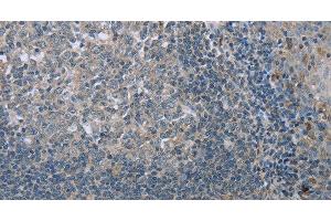 Immunohistochemistry of paraffin-embedded Human tonsil tissue using FAR2 Polyclonal Antibody at dilution 1:40