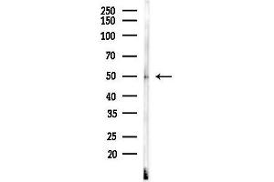 anti-Iroquois Homeobox Protein 2 (IRX2) (Internal Region) antibody