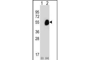 Western blot analysis of GCDH (arrow) using rabbit polyclonal GCDH Antibody (C-term) (ABIN656829 and ABIN2846038). (GCDH anticorps  (C-Term))