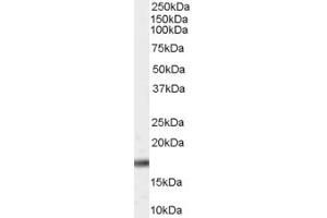 Western Blotting (WB) image for anti-Cell Division Cycle 27 Homolog (S. Cerevisiae) (CDC27) (C-Term) antibody (ABIN2788001) (CDC27 anticorps  (C-Term))