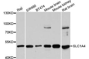 Western blot analysis of extracts of various cells, using SLC1A4 antibody. (SLC1A4 anticorps)