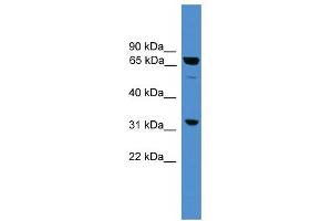 WB Suggested Anti-SNAG1 Antibody Titration: 0. (SNX18 anticorps  (Middle Region))