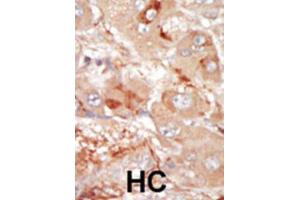 Immunohistochemistry (IHC) image for anti-Serine/threonine-Protein Kinase PRP4 Homolog (PRPF4B) antibody (ABIN3003283) (PRPF4B anticorps)