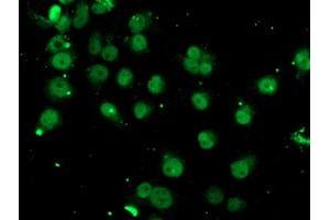 Image no. 3 for anti-Spastic Paraplegia 7 (SPG7) (AA 300-573) antibody (ABIN1491369)