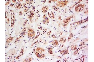 Formalin-fixed and paraffin embedded human kidney labeled with Anti-NOS-2/iNOS Polyclonal Antibody, Unconjugated  at 1:200 followed by conjugation to the secondary antibody and DAB staining. (NOS2 anticorps  (AA 14-100))