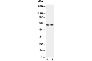 Western blot testing of Src antibody and Lane 1:  COLO320;  2: A549 lysate (Src anticorps  (AA 2-368))