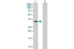 Western Blot analysis of LDHC expression in transfected 293T cell line by LDHC MaxPab polyclonal antibody. (Lactate Dehydrogenase C anticorps  (AA 1-332))