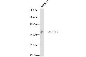 Western blot analysis of extracts of Rat liver using ZSCAN31 Polyclonal Antibody at dilution of 1:3000. (ZKSCAN2 anticorps)