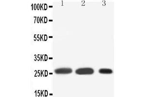 Anti-SFTPA1 antibody, Western blotting Lane 1: Rat Lung Tissue Lysate Lane 2: Rat Lung Tissue Lysate Lane 3: MK(55KD)