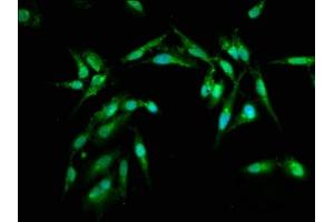 Immunofluorescence staining of Hela cells with ABIN7143473 at 1:100, counter-stained with DAPI. (ARL1 anticorps  (AA 2-181))
