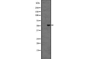 Western blot analysis of DRD5 expression in HEK293 cells ,The lane on the left is treated with the antigen-specific peptide. (DRD5 anticorps  (N-Term))