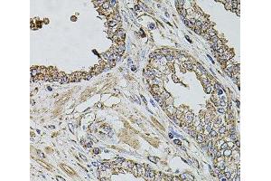 Immunohistochemistry of paraffin-embedded Human prostate using TMC1 Polyclonal Antibody at dilution of 1:100 (40x lens).