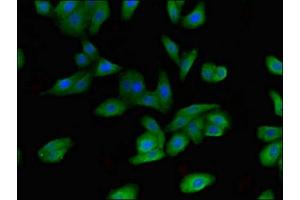 Immunofluorescent analysis of HepG2 cells using ABIN7152451 at dilution of 1:100 and Alexa Fluor 488-congugated AffiniPure Goat Anti-Rabbit IgG(H+L)