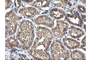 Immunohistochemical staining of paraffin-embedded Human Kidney tissue using anti-TUBAL3 mouse monoclonal antibody. (TUBAL3 anticorps  (AA 150-446))