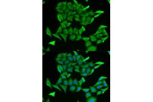 Immunofluorescence (IF) image for anti-Myoglobin (MB) antibody (ABIN1876659) (Myoglobin anticorps)