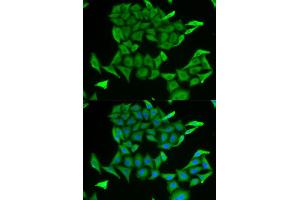 Immunofluorescence (IF) image for anti-MB antibody (ABIN1876659) (MB anticorps)