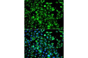 Immunofluorescence analysis of A549 cells using CAPN5 antibody. (Calpain 5 anticorps  (AA 361-640))