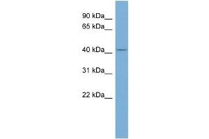 WB Suggested Anti-TRIM44 Antibody Titration: 0. (TRIM44 anticorps  (Middle Region))
