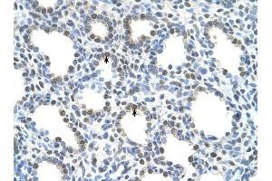 SLC15A4 antibody was used for immunohistochemistry at a concentration of 4-8 ug/ml to stain Alveolar cells (arrows) in Human Lung. (SLC15A4 anticorps  (N-Term))