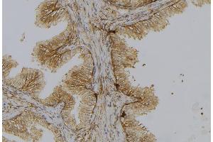 ABIN6278443 at 1/100 staining Mouse colon tissue by IHC-P. (CTP Synthase anticorps  (C-Term))