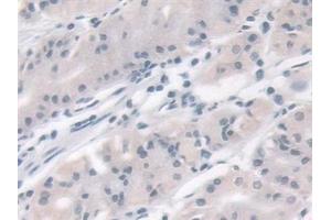 Detection of VAPB in Human Stomach Tissue using Polyclonal Antibody to Vesicle Associated Membrane Protein Associated Protein B (VAPB)