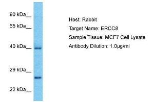 Host:  Rabbit  Target Name:  ERCC8  Sample Type:  MCF7 Whole Cell lysates  Antibody Dilution:  1.