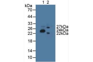 Western blot analysis of (1) Porcine Stomach Tissue and (2) Mouse Brain Tissue. (GLTP anticorps  (AA 2-209))