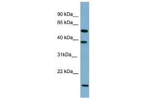 SLC10A1 antibody used at 1 ug/ml to detect target protein. (SLC10A1 anticorps)