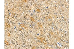 ABIN6256273 and ABIN6277785 at 1/100 staining Rat brain tissue by IHC-P. (Doublecortin anticorps  (pSer335))