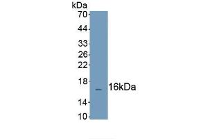 Detection of Recombinant CFHR3, Human using Polyclonal Antibody to Complement Factor H Related Protein 3 (CFHR3) (CFHR3 anticorps  (AA 208-330))